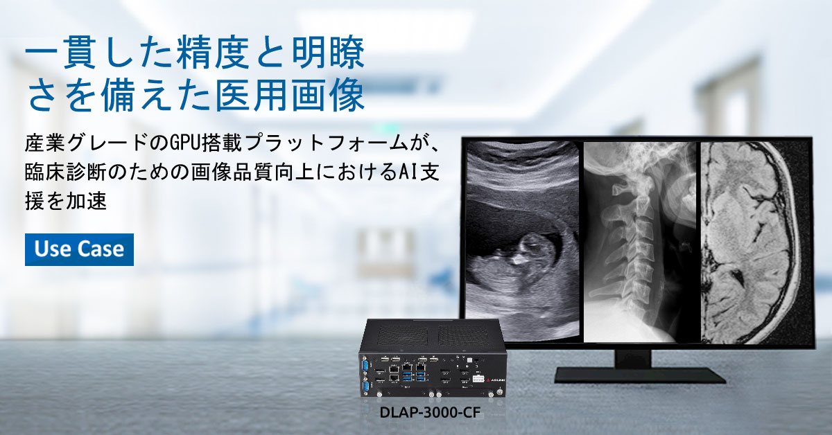 AI_AOI_Use_Case